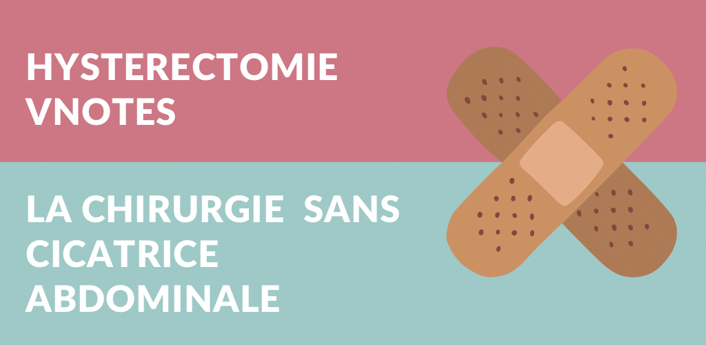 Hystérectomie vNOTES en ambulatoire et sans cicatrice abdominale par le Dr Olivier Marpeau à Aix-en-Provence